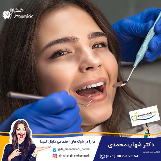 آیا امکان دارد به جای کامپوزیت ونیر های خود لمینت قرار دهم؟ - کلینیک دندانپزشکی دکتر شهاب محمدی